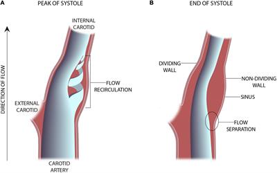 The Rheology of the Carotid Sinus: A Path Toward Bioinspired Intervention